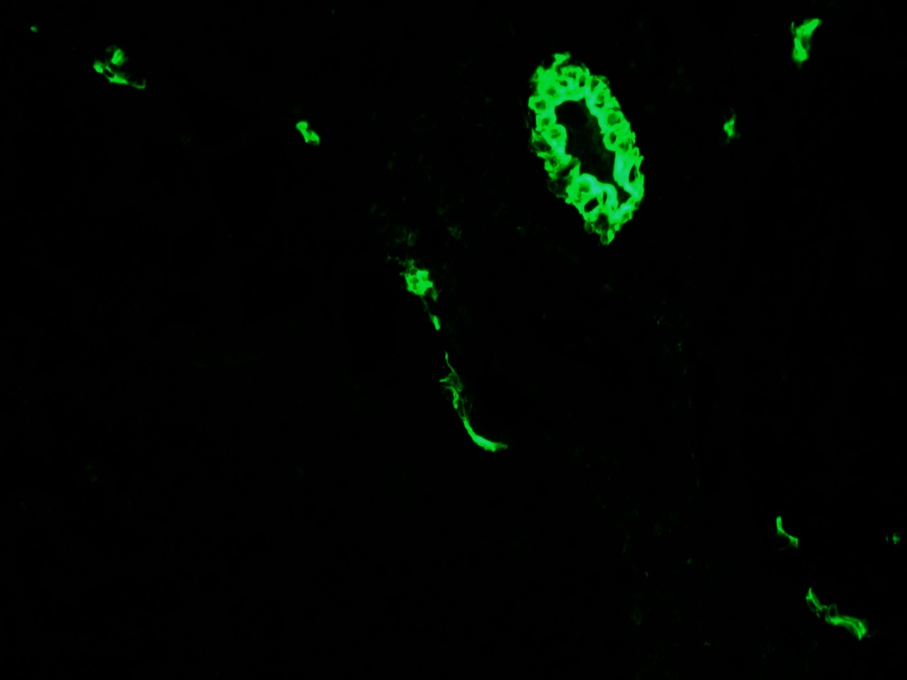Figure 1 - Immunohistochemistry of MUB0315P (RCK105) on frozen sections of swine liver showing positive staining in the epithelial cells lining the bile ducts and no reactivity in hepatocytes or connective tissue. Dilution 1:500